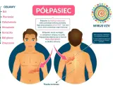 Objawy półpaśca: ból, pieczenie, odrętwienie, mrowienie, gorączka, ból głowy, zmęczenie. Jak złagodzić ból przy półpaścu? Półpasiec to wirus VZV.