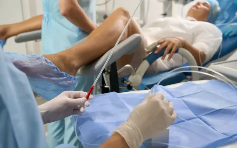 Przygotowanie do zabiegu z użyciem cewnika u kobiety. Personel medyczny w rękawiczkach trzyma narzędzia.