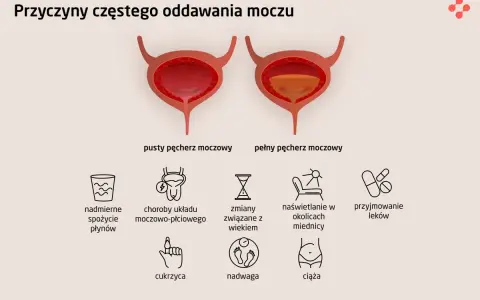 Ilustracja pokazuje pusty i pełny pęcherz moczowy, wyjaśniając przyczyny częstego oddawania moczu, w tym uczucie pełnego pęcherza.
