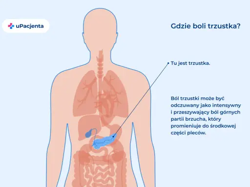 Anatomia człowieka z zaznaczoną trzustką. Ból trzustki może być odczuwany jako intensywny ból brzucha promieniujący do pleców.