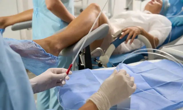 Przygotowanie do zabiegu z użyciem cewnika u kobiety. Personel medyczny w rękawiczkach trzyma narzędzia.