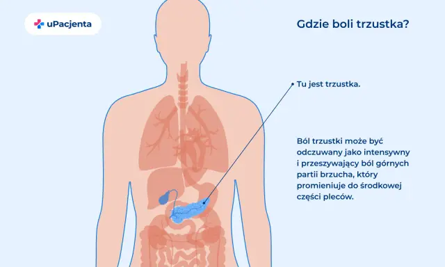 Anatomia człowieka z zaznaczoną trzustką. Ból trzustki może być odczuwany jako intensywny ból brzucha promieniujący do pleców.